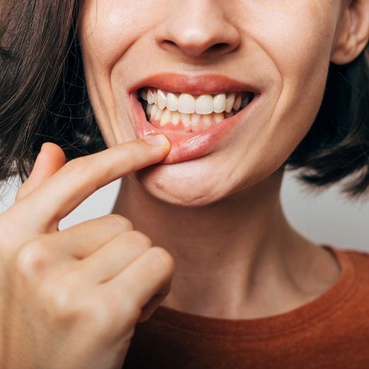 What is Gum Disease?