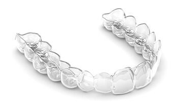 Invisalign Aligners