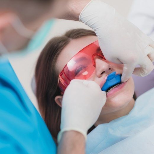 Fluoride Treatment
