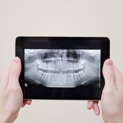 Digital Dental X-Rays