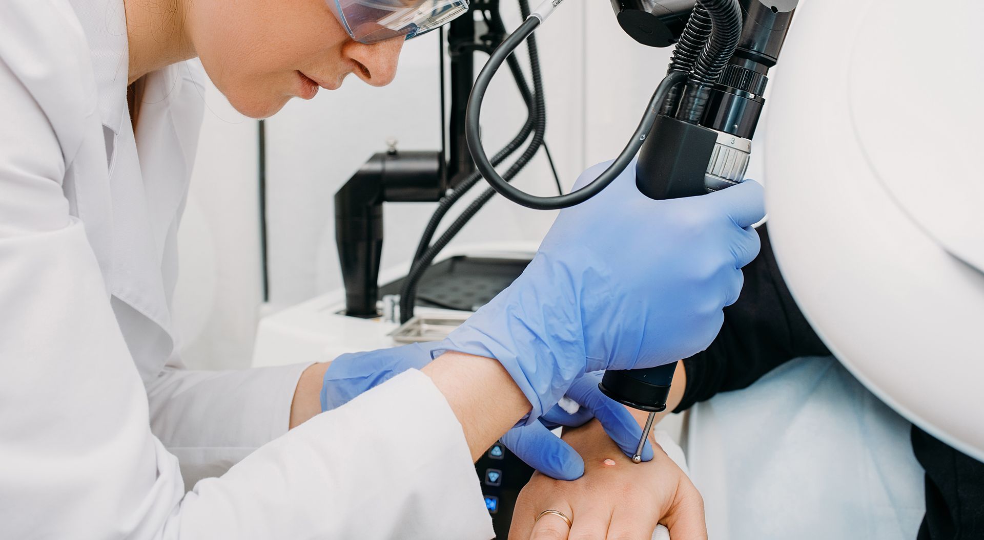 A medical professional in blue gloves uses a laser on a patient's hand.
