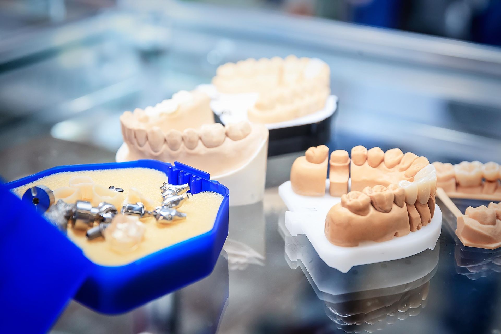 Dental models with a blue tray of metal tools on a workbench