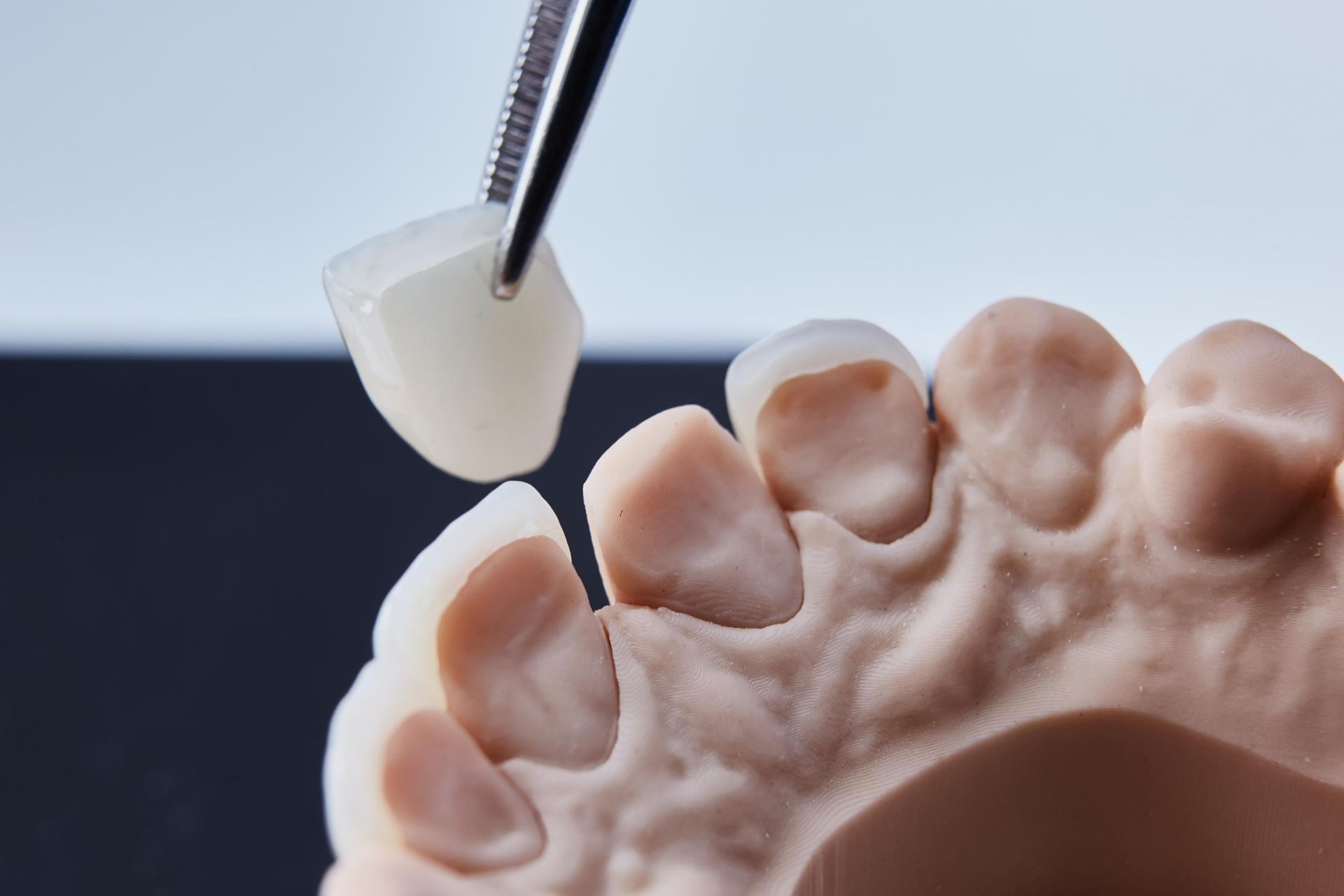 Dental mold being trimmed with a tool, showing close-up white plaster teeth on a work surface