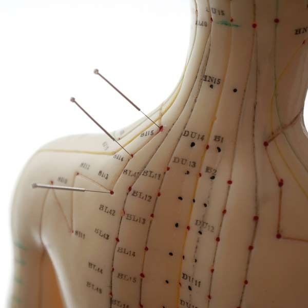 A torso model with acupuncture needles inserted at various points along the back and neck.