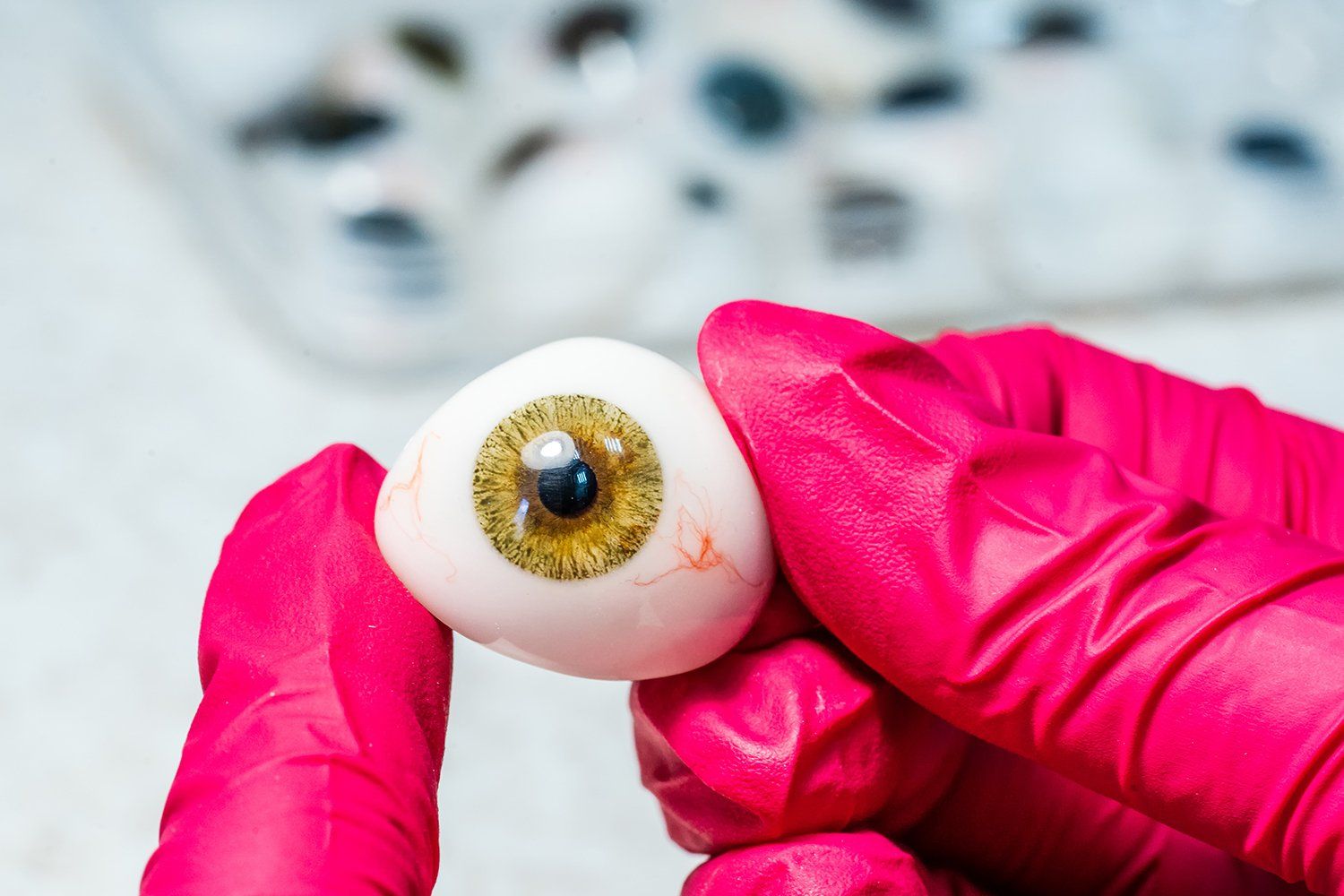 Mãos com luvas rosas segurando uma prótese ocular