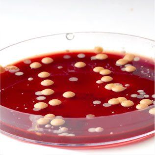 Un gros plan d'une boîte de Petri remplie de liquide rouge