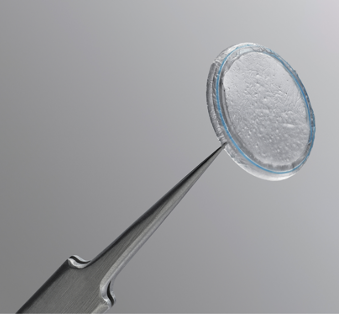 A close up of an amniotic membrane on a pair of tweezers