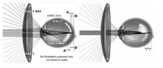 Diagram comparing light focusing on the retina through H.A.L.T. spectacle lenses versus standard single-vision lenses.