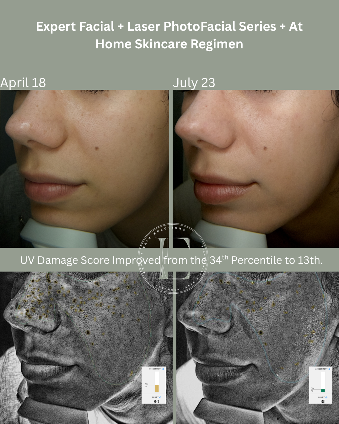 A before and after photo of a woman 's face