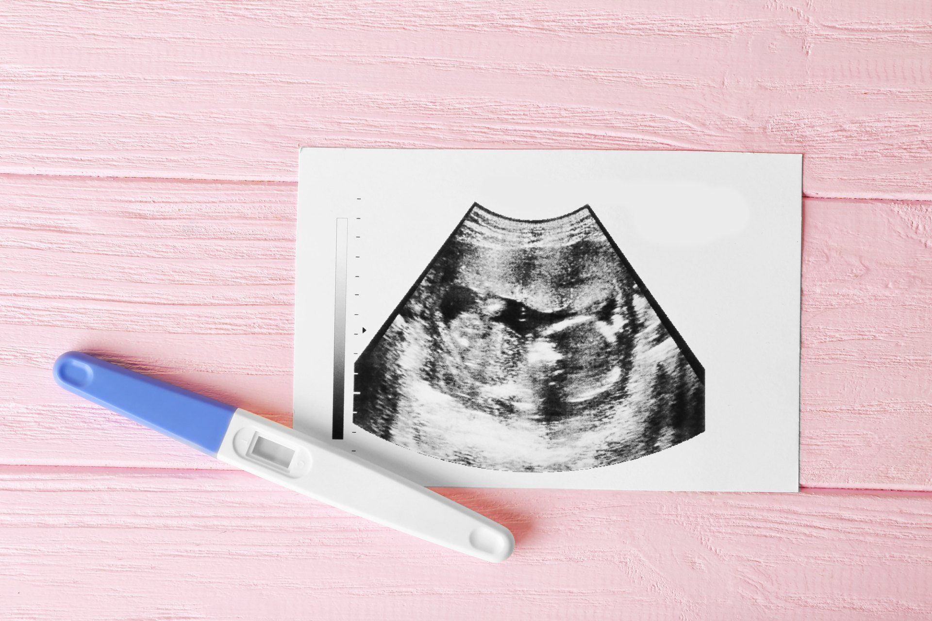 test di gravidanza ed ecografia