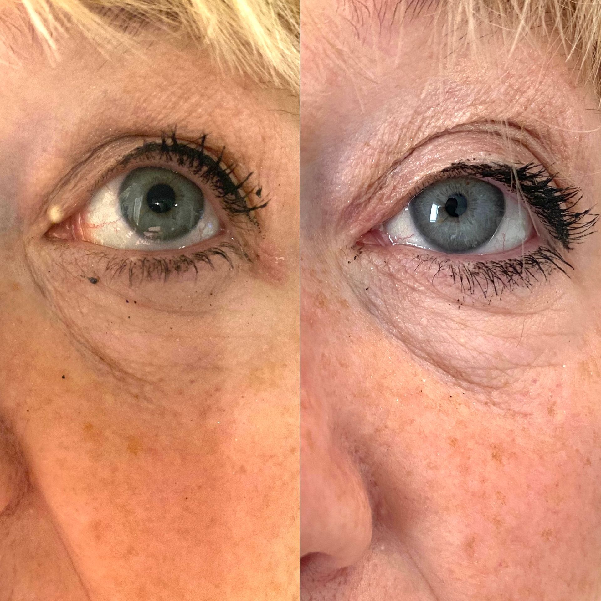 A before and after photo of a woman 's eyes.