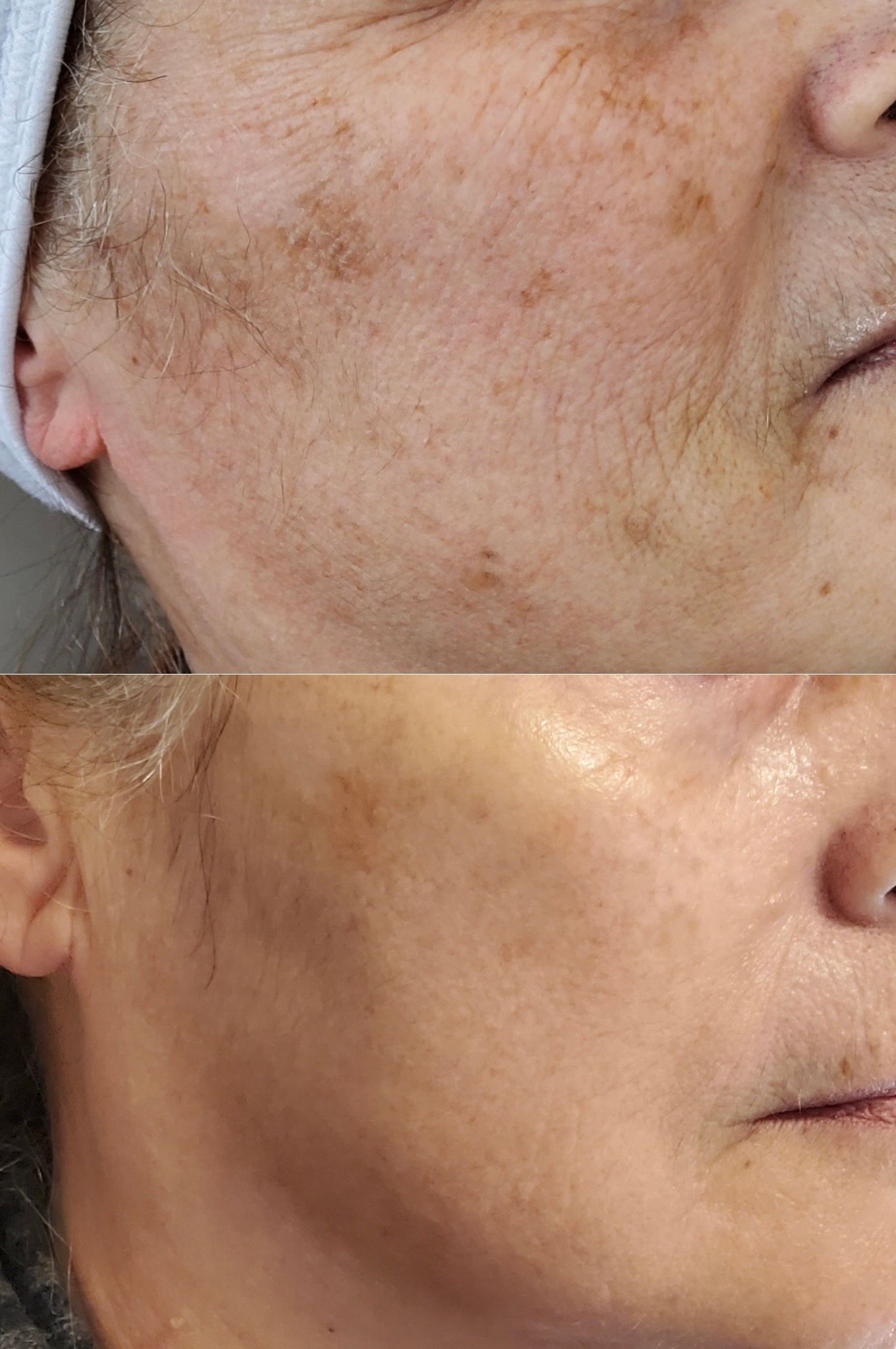 A woman with curly hair is smiling and touching her face.