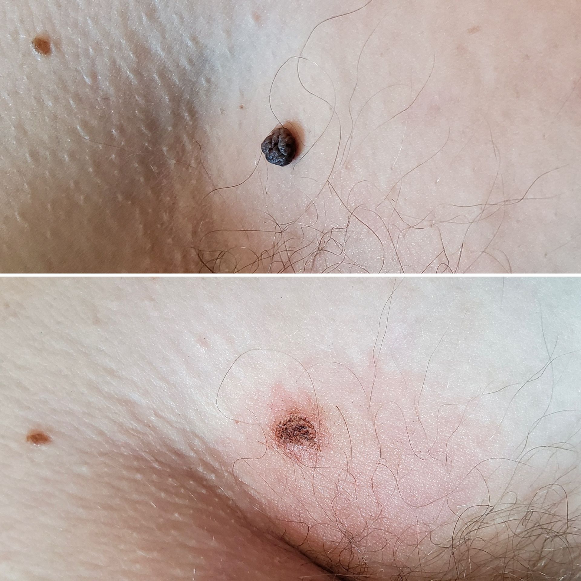 A woman is touching her face with her hand and looking at the camera.