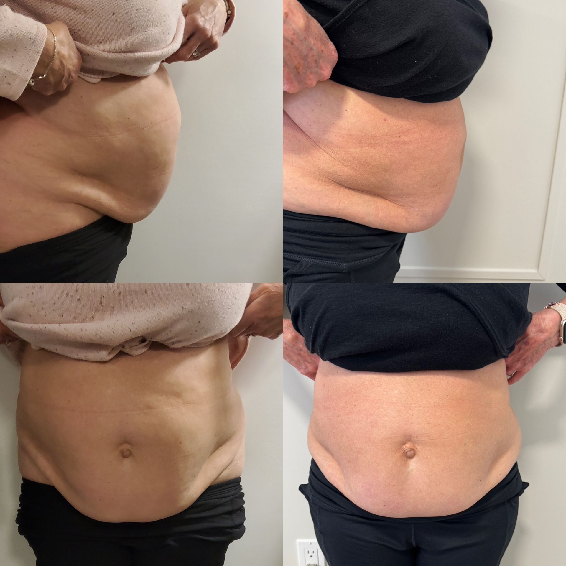 A woman in a white bikini is standing in front of a beige background.