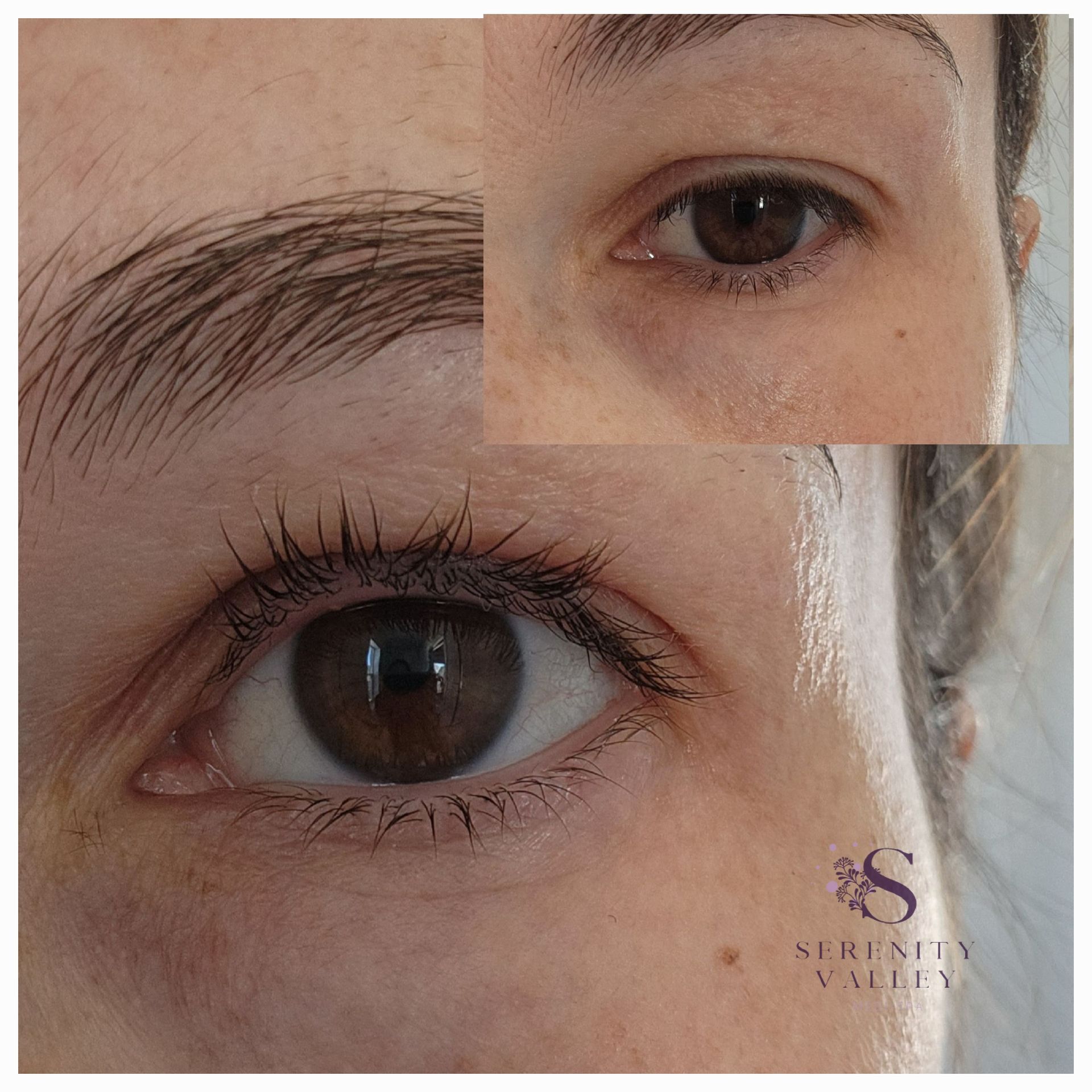 A before and after photo of a woman 's eye