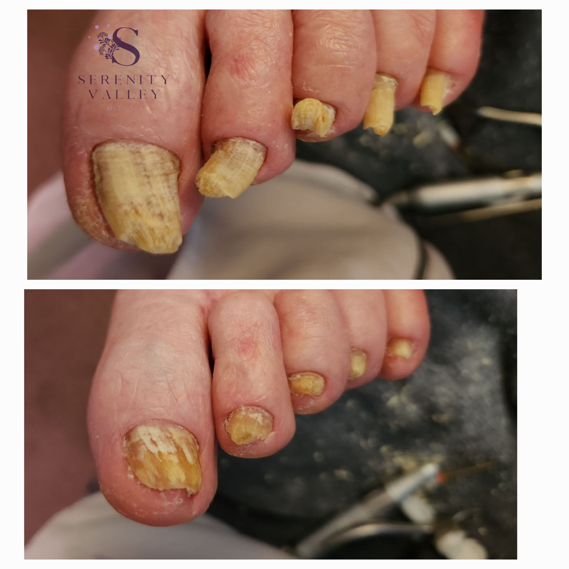 A before and after photo of a person 's nails.