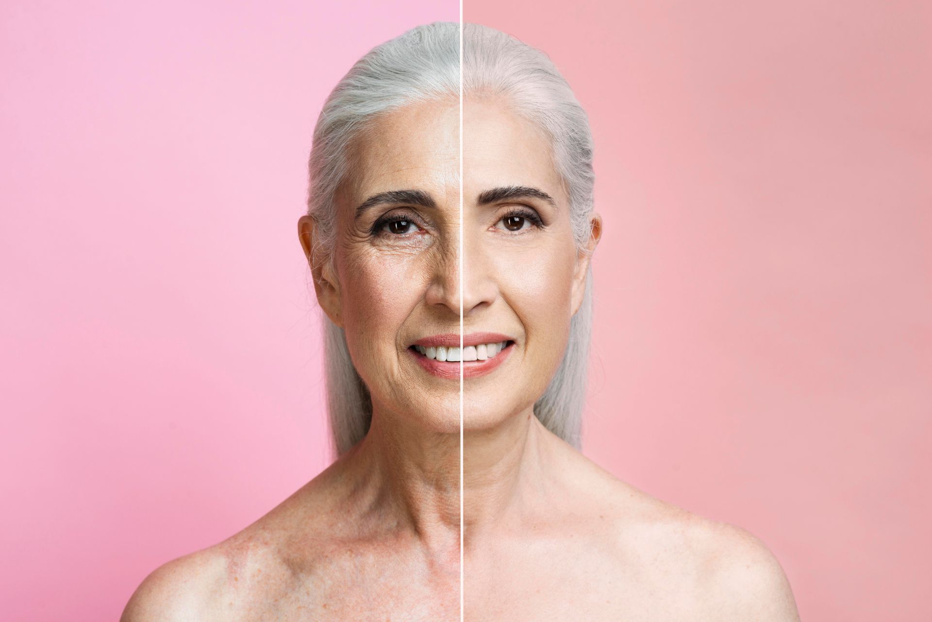 A before and after photo of an older woman 's face on a pink background.