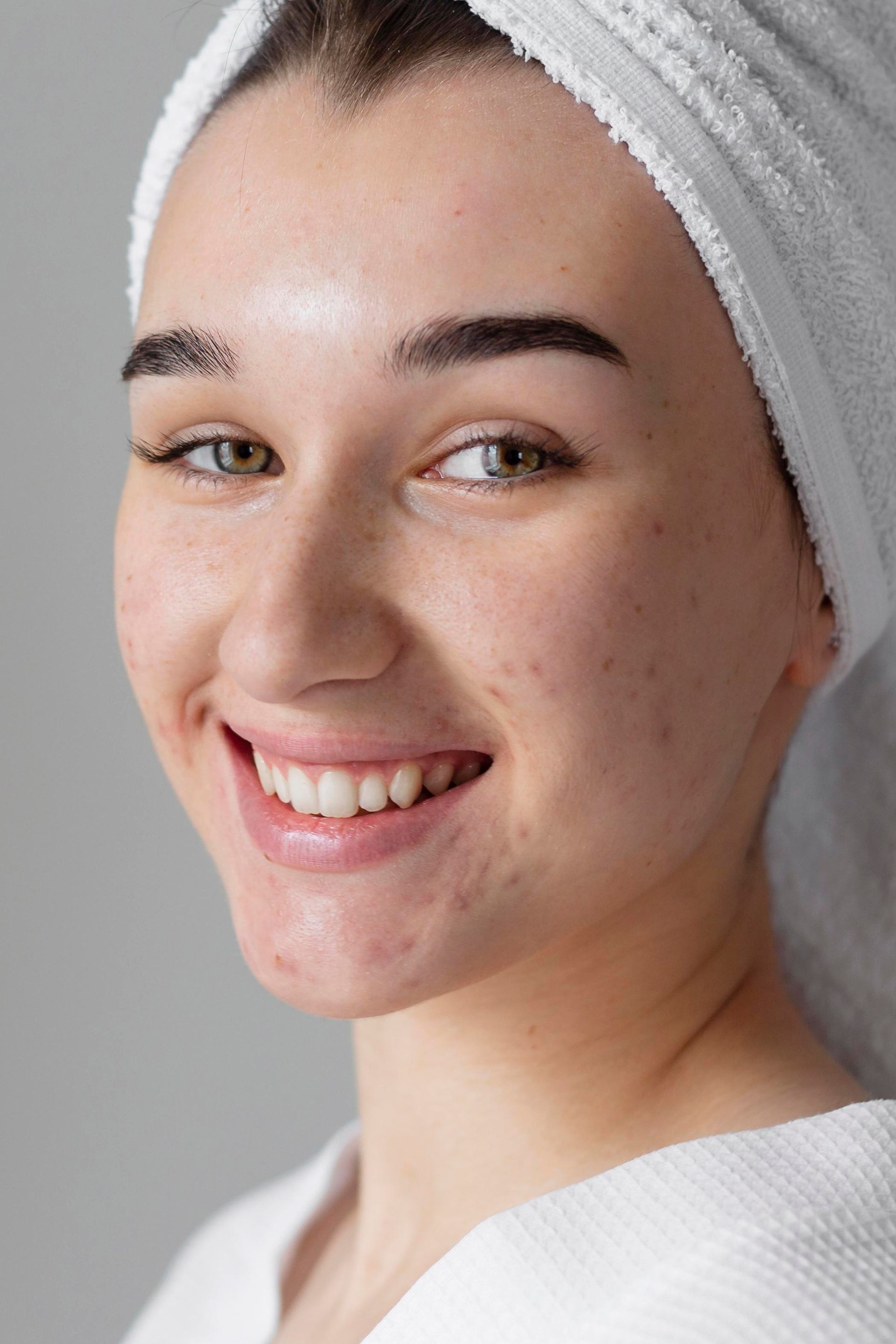 A woman with a towel wrapped around her head and acne scar is smiling.