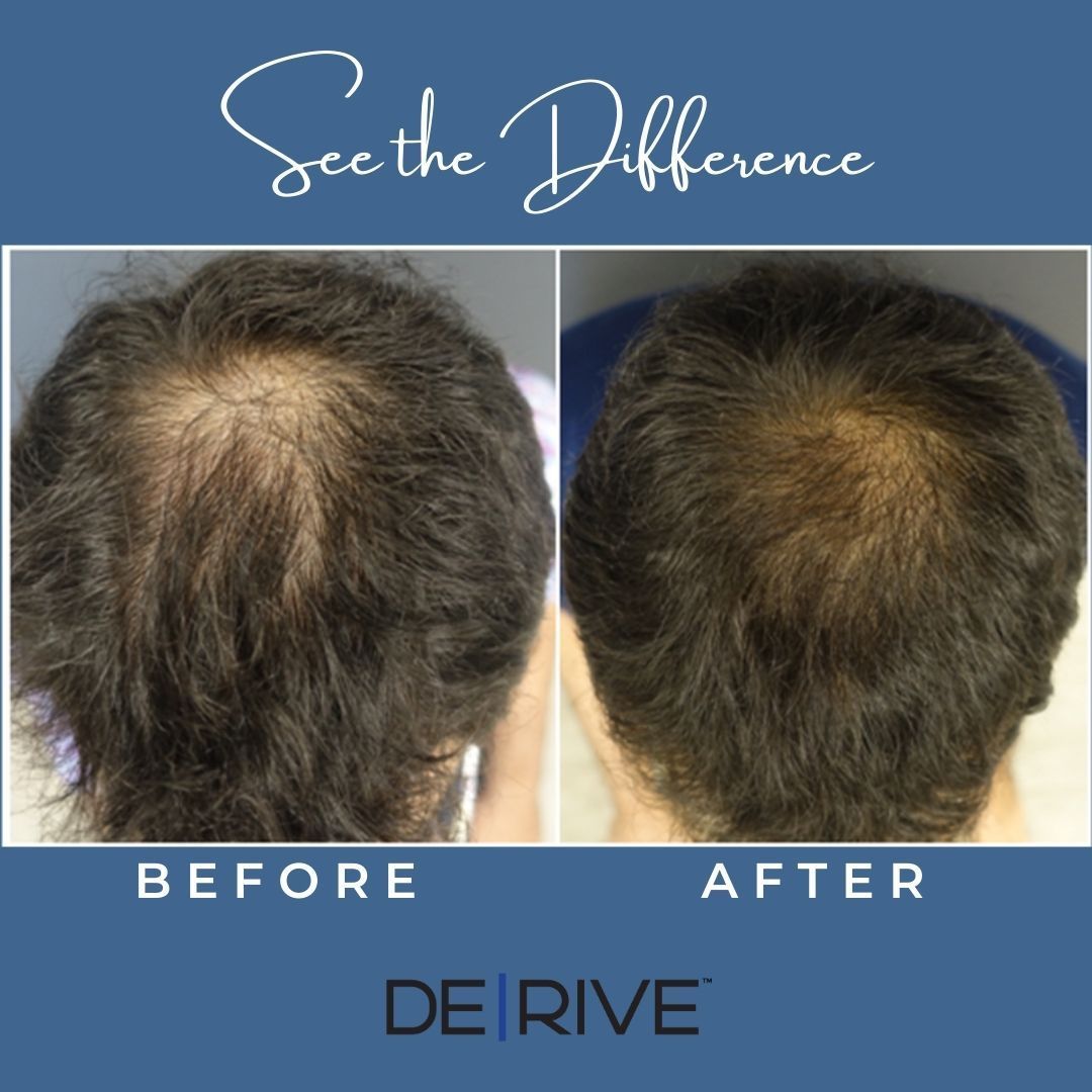 A before and after picture of a man 's hair