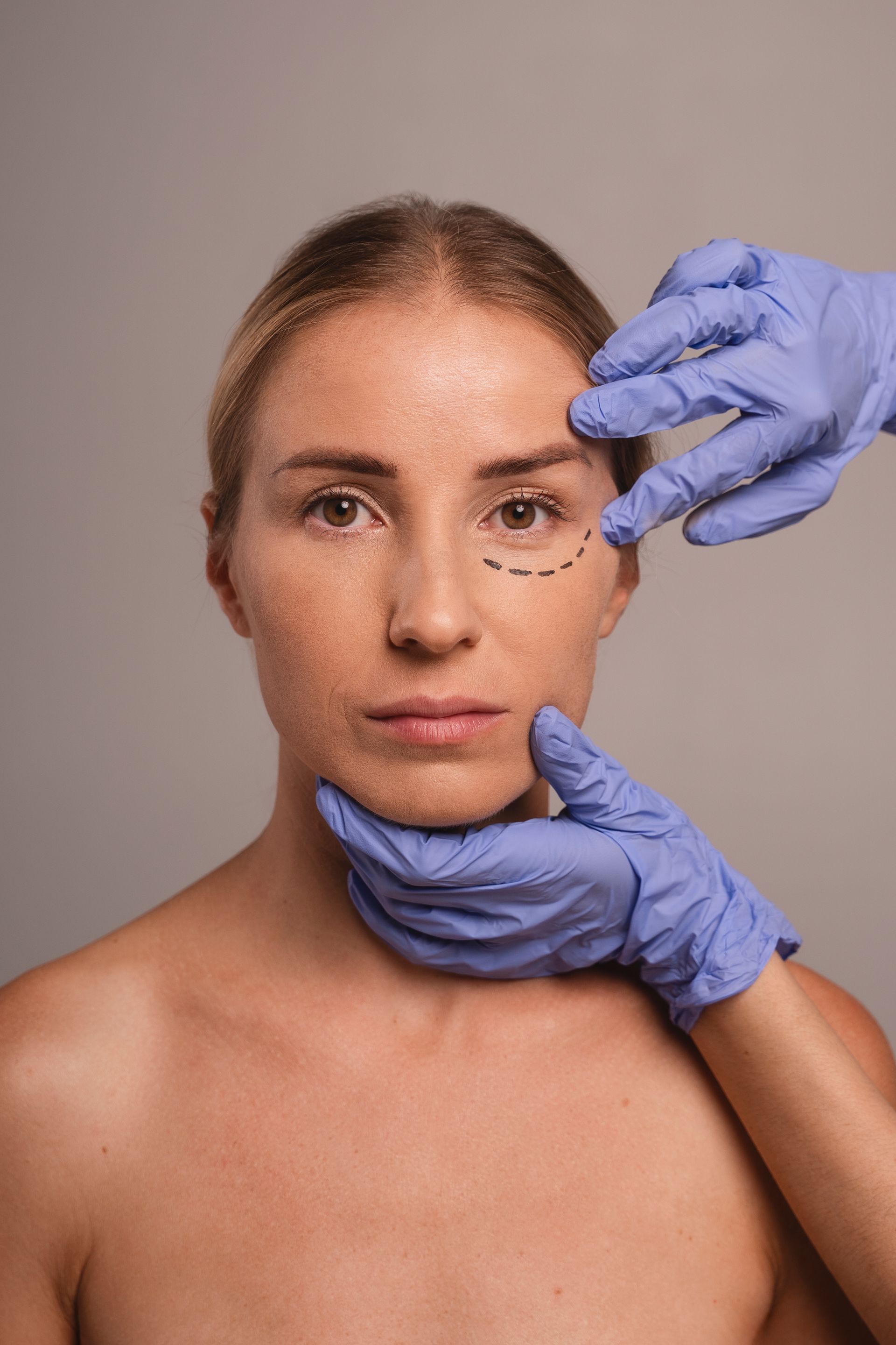 A woman is getting a plastic surgery on her face.