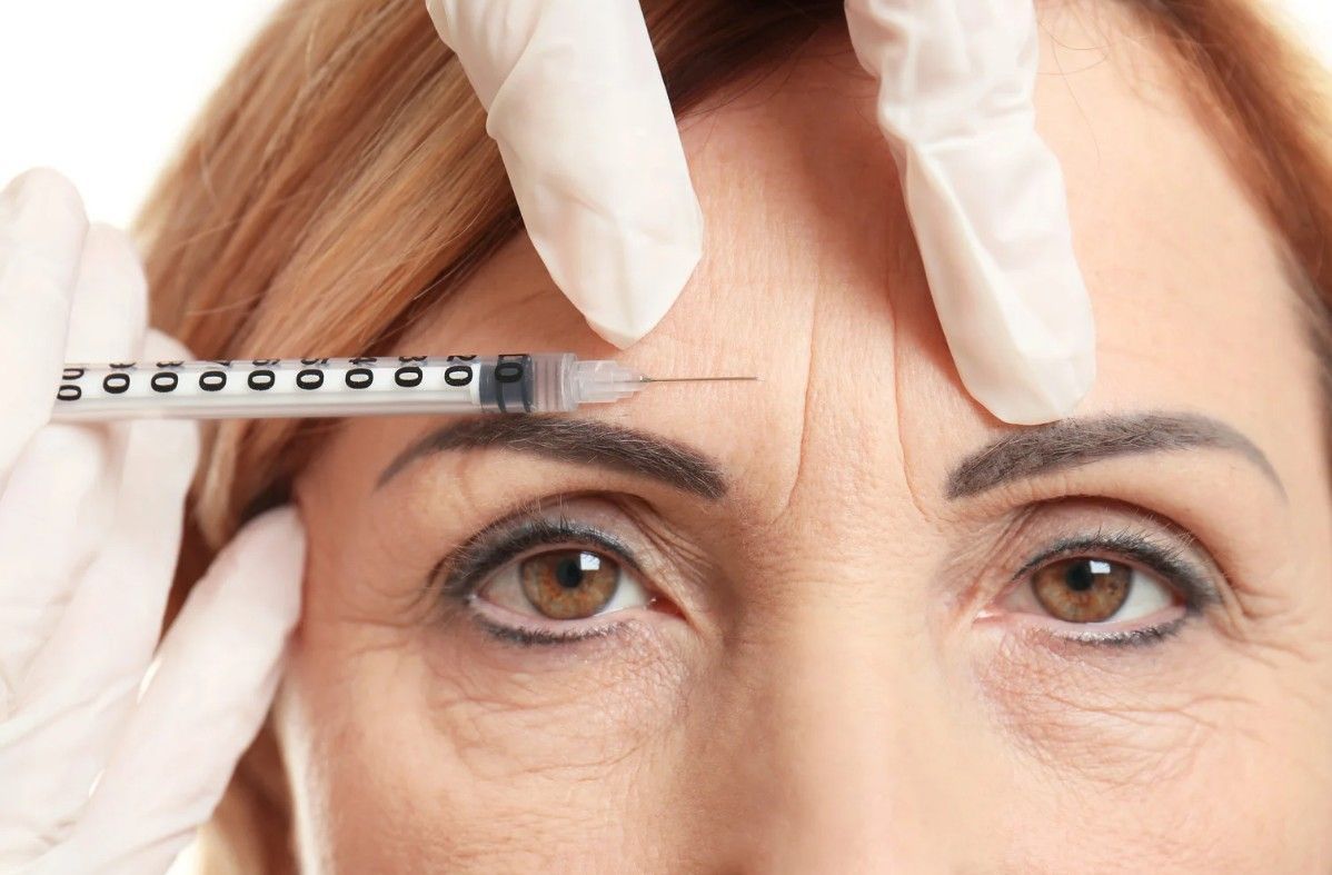 botox being injected into the forehead of a client in Nottingham