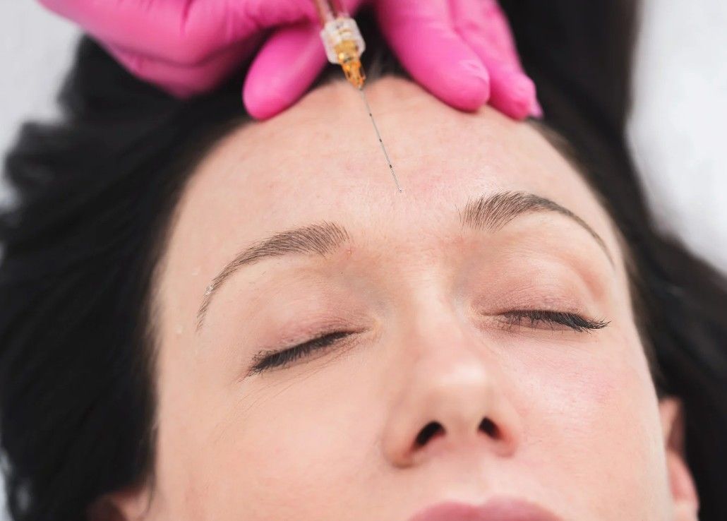 Signature Aesthetics injecting a dermal filler into the forehead of a client in Nottingham