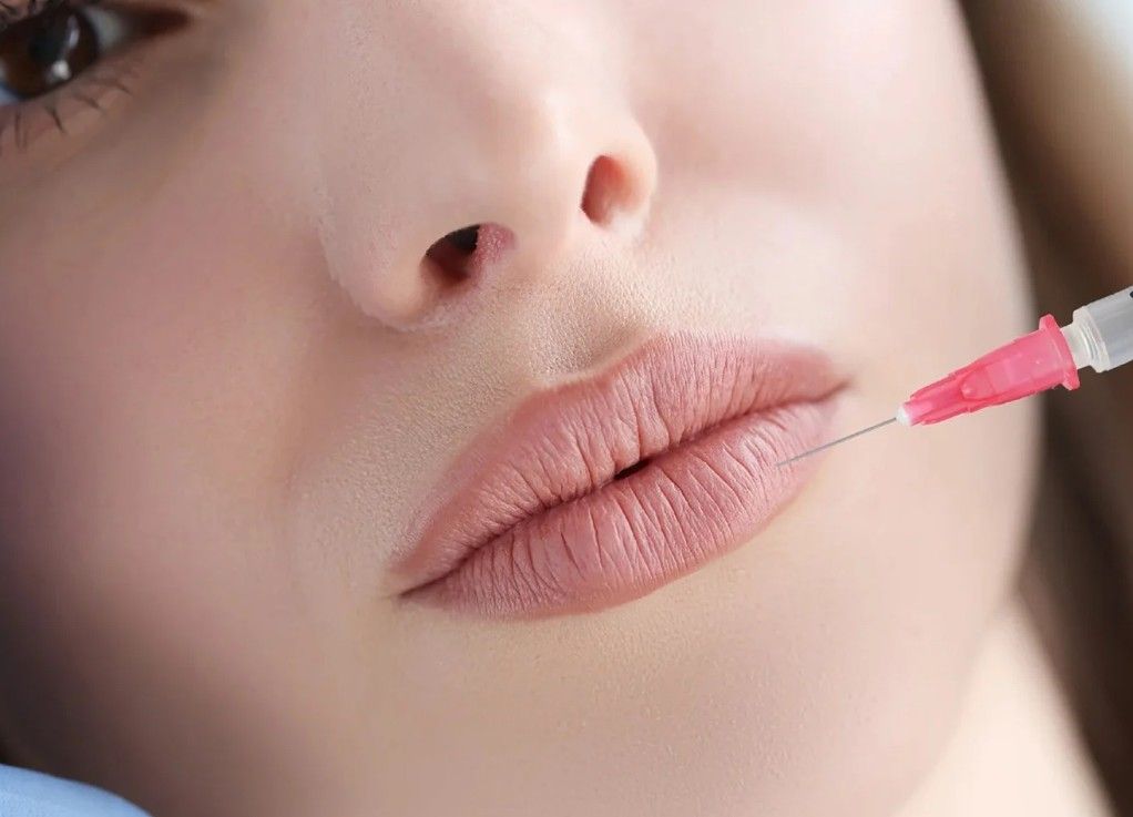 Signature Aesthetics administering lip filler to a client in Nottingham