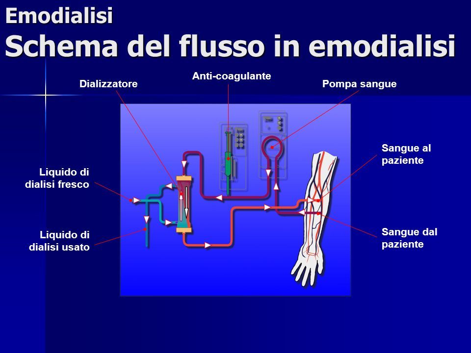 Schema dell'emodialisi