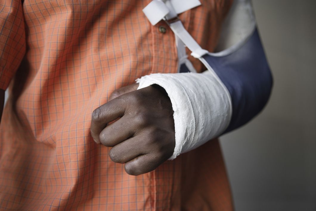 Arm Injury
