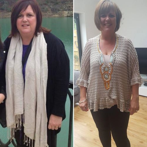 Before/after of a woman