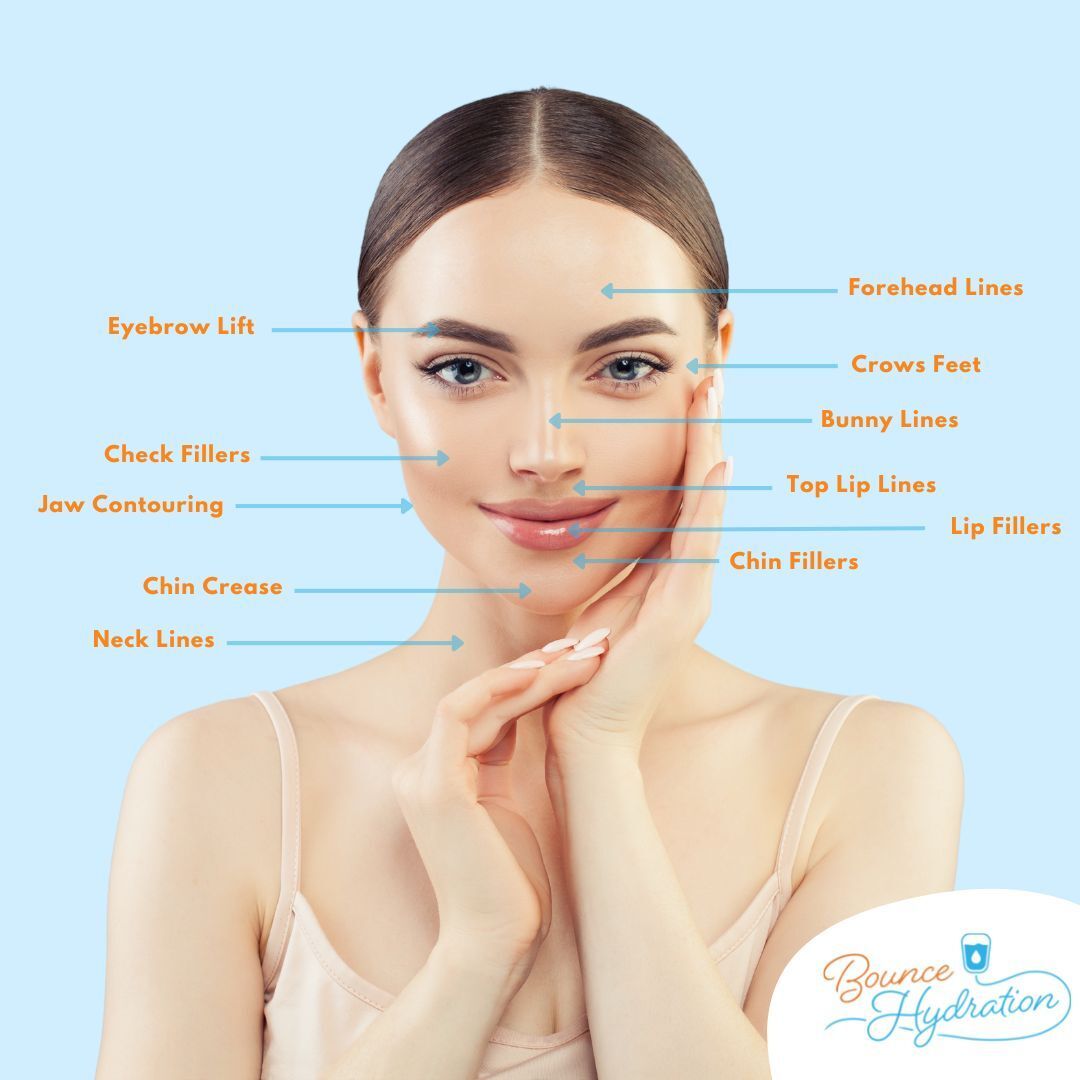 Facial FIller Areas