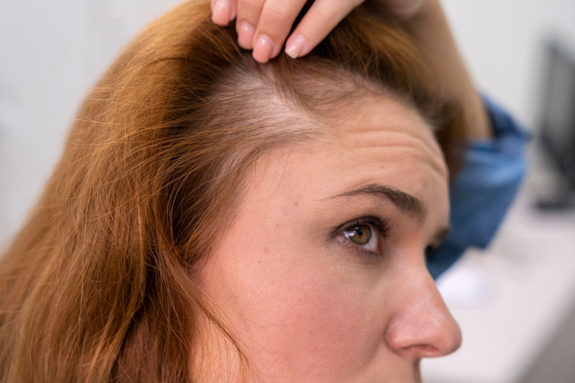 A close-up of a menopausal woman in need of a hair loss treatment, parting her hair to reveal a thin