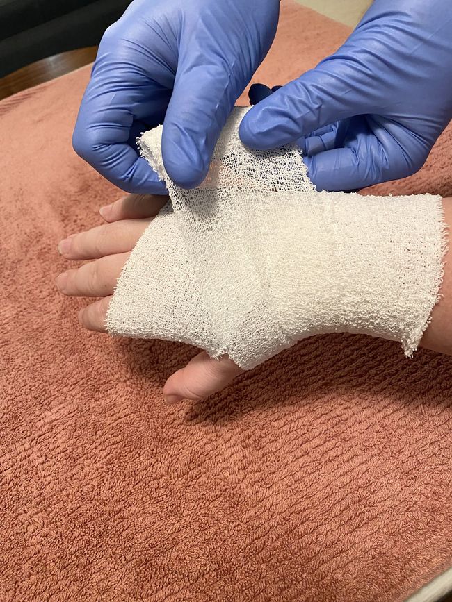 Bandaging a Hand — Newcastle, NSW — Moxey First Aid