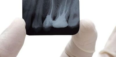 DRA. ELIZABETH GONZÁLEZ ENDODONCIA INTEGRAL - Diagnóstico integral