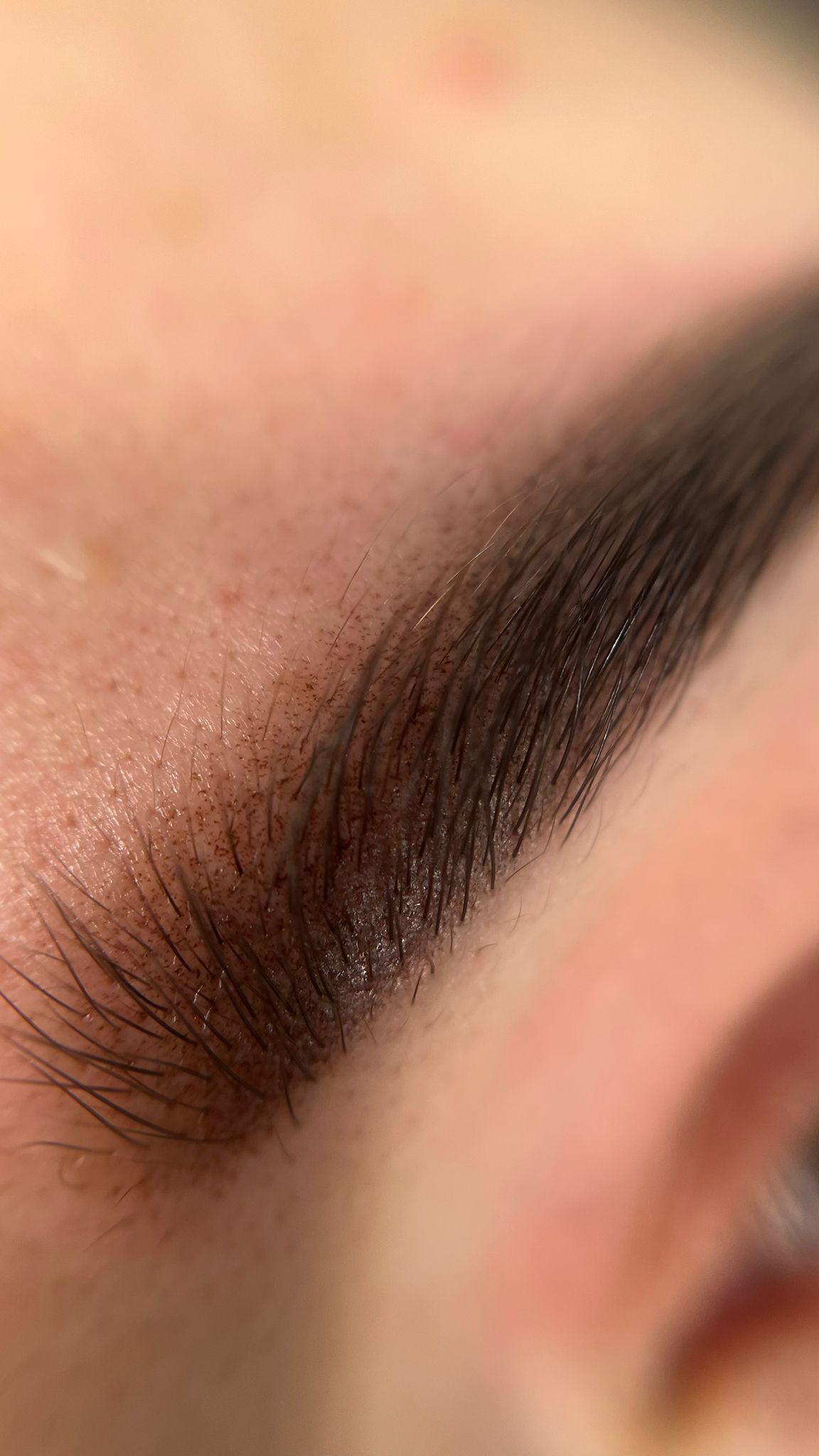 RICOSTRUZIONE UNGHIE