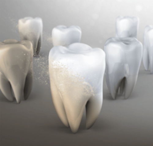 Teeth whitening concept: teeth transitioning from dull to bright white with a misty effect.