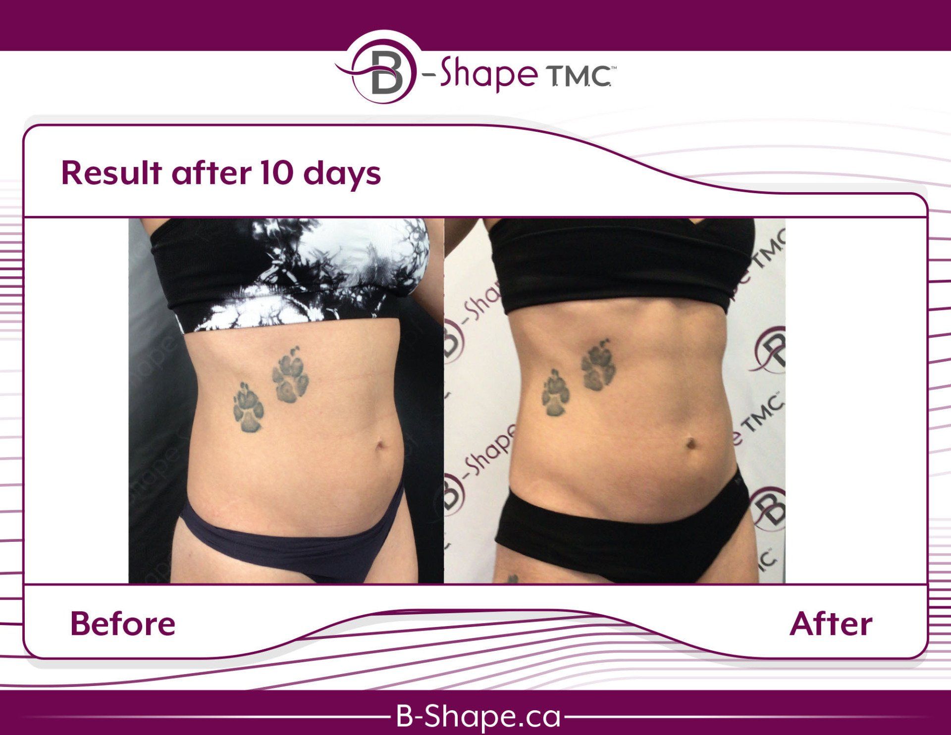 Before and after body transformation after 10 days. Woman's torso; appears slimmer after treatment.