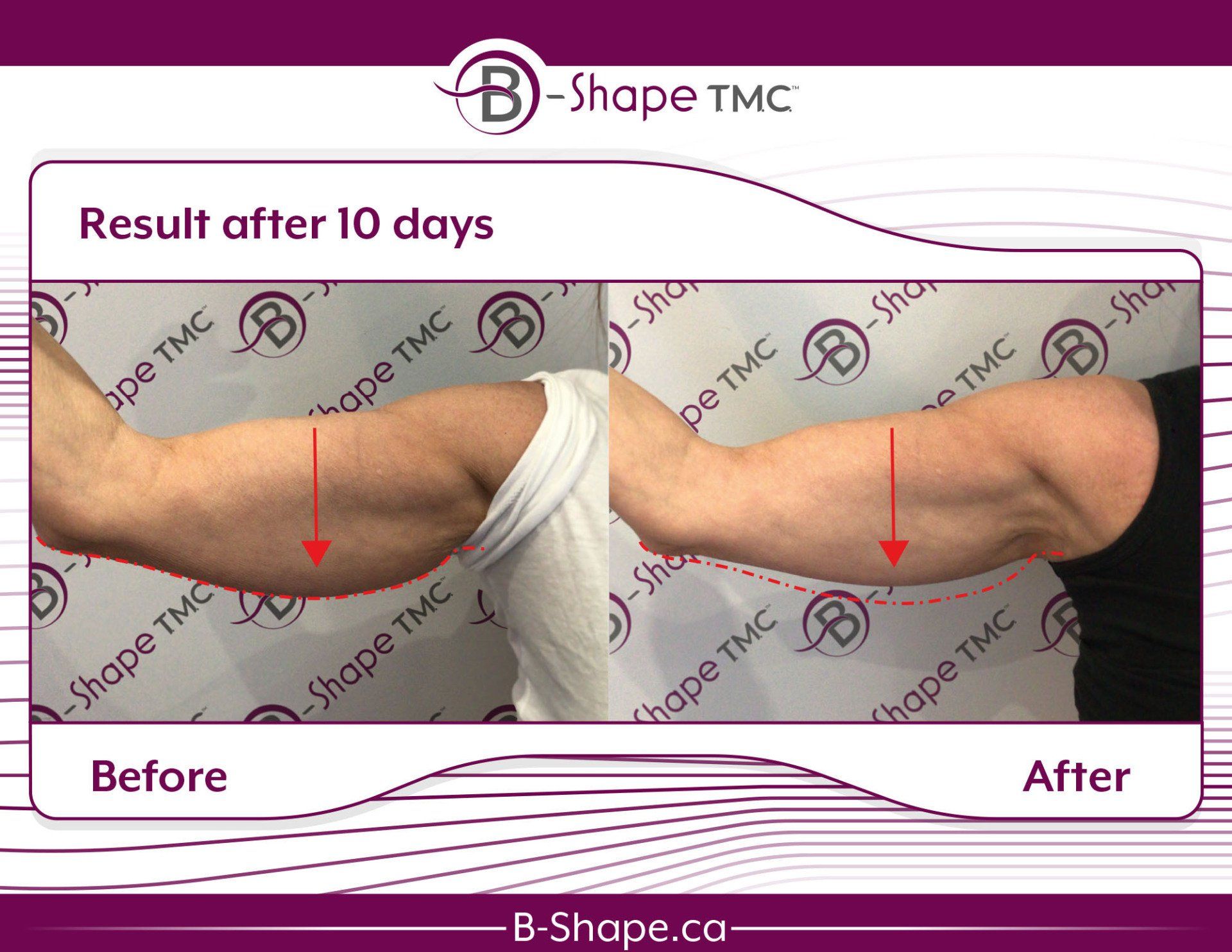 Our Treatment: What It Does | B-Shape T.M.C.