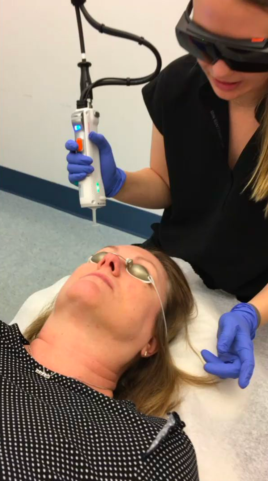 A woman is getting a laser treatment on her face.