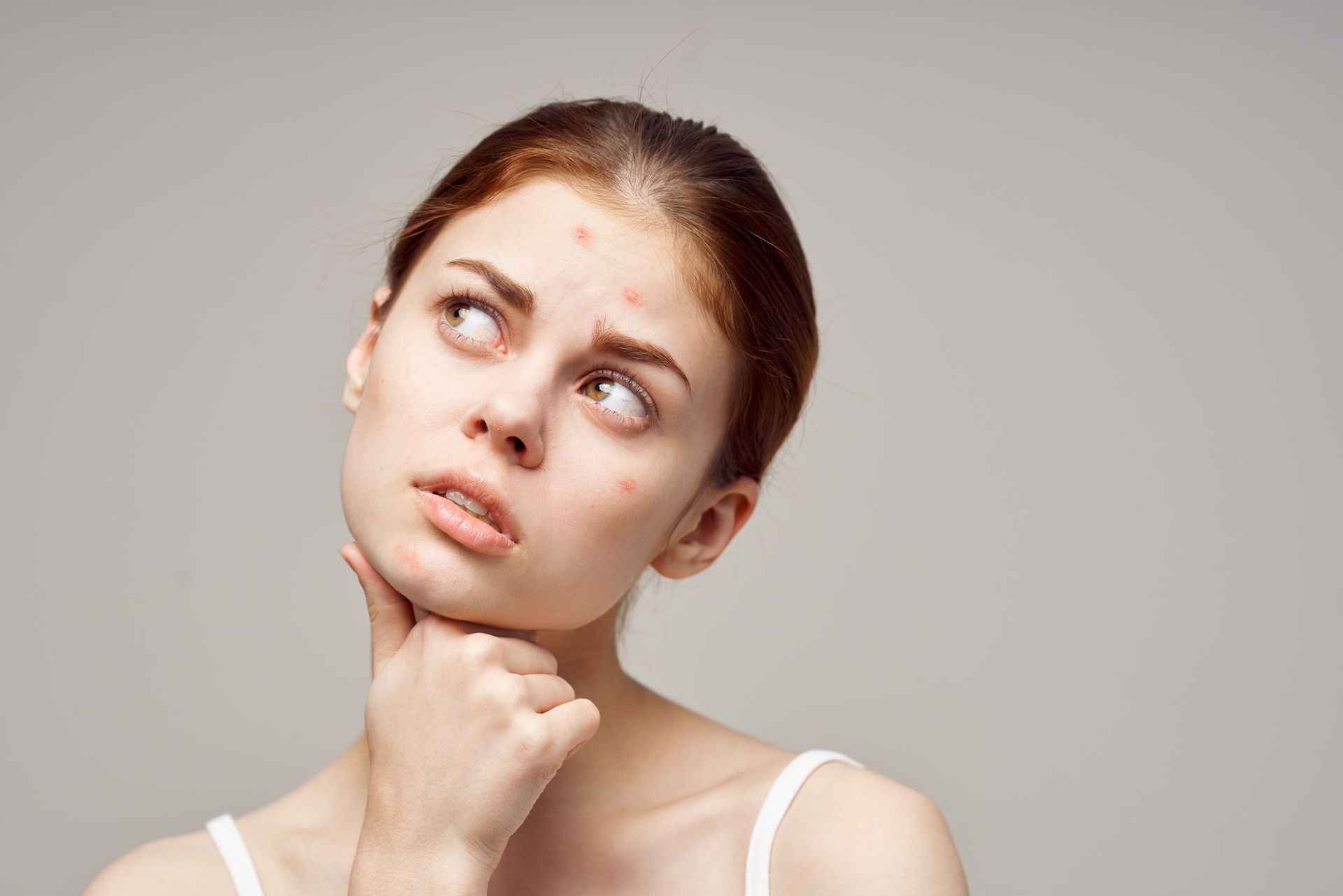 Woman with acne looking upward, hand on neck, concerned expression.