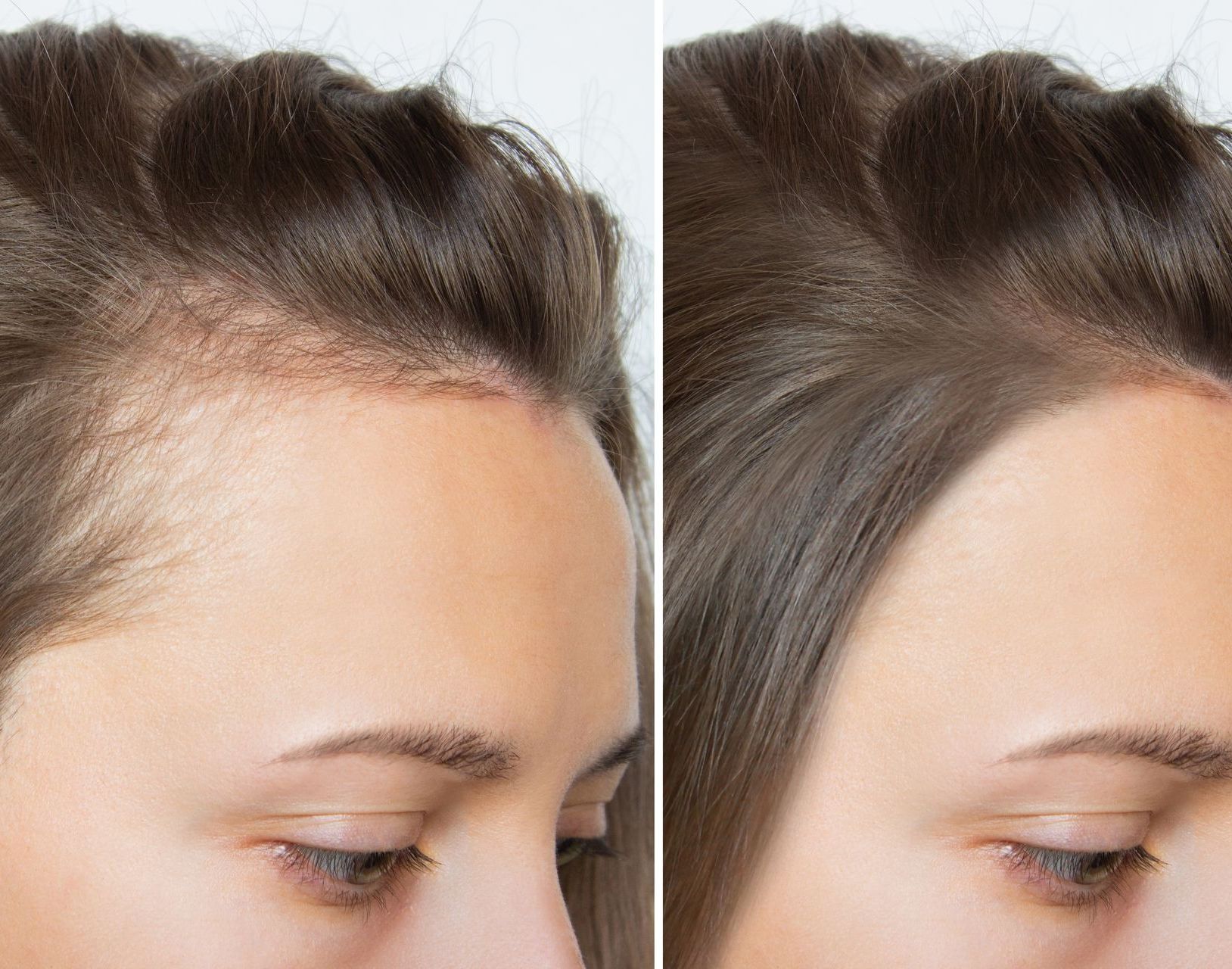 A before and after photo of a woman 's hair growth.