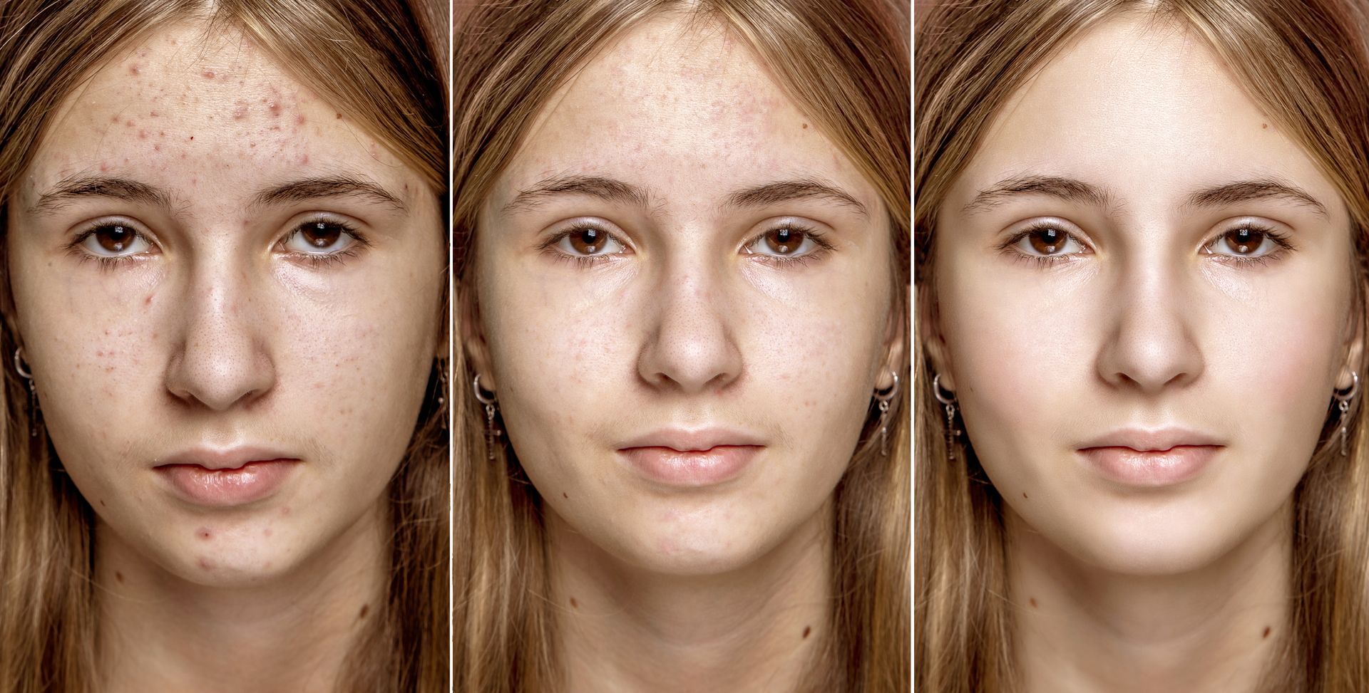 Three portraits: woman with acne, retouched face, and final enhanced portrait with blush.