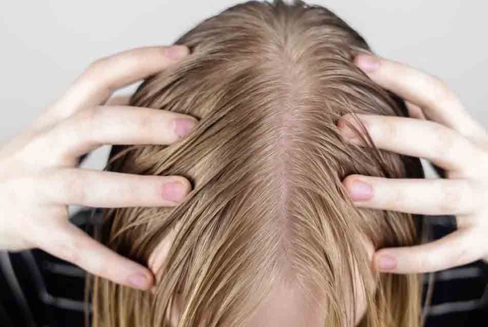 Person's head with parting showing scalp, wet blonde hair, hands on the sides.