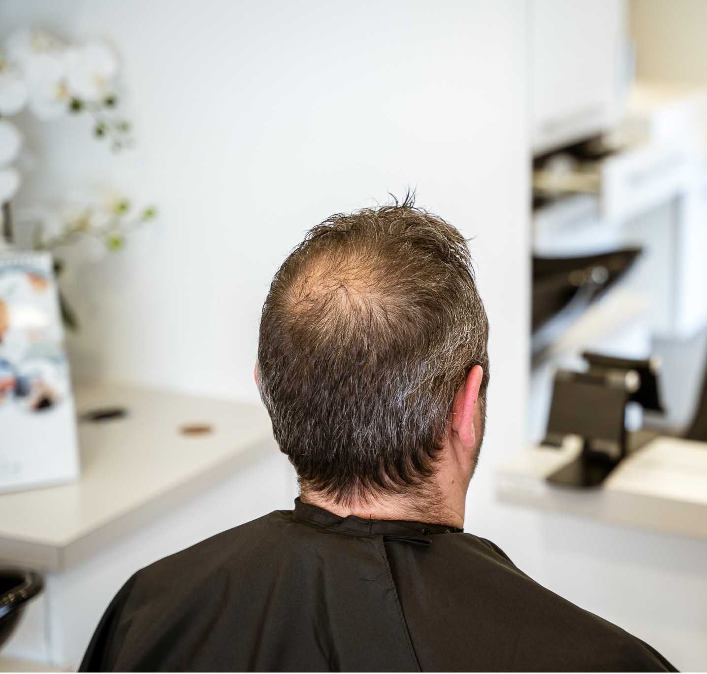 Man with thinning hair at a salon, wearing a black cape. White walls and a mirror are in the background.