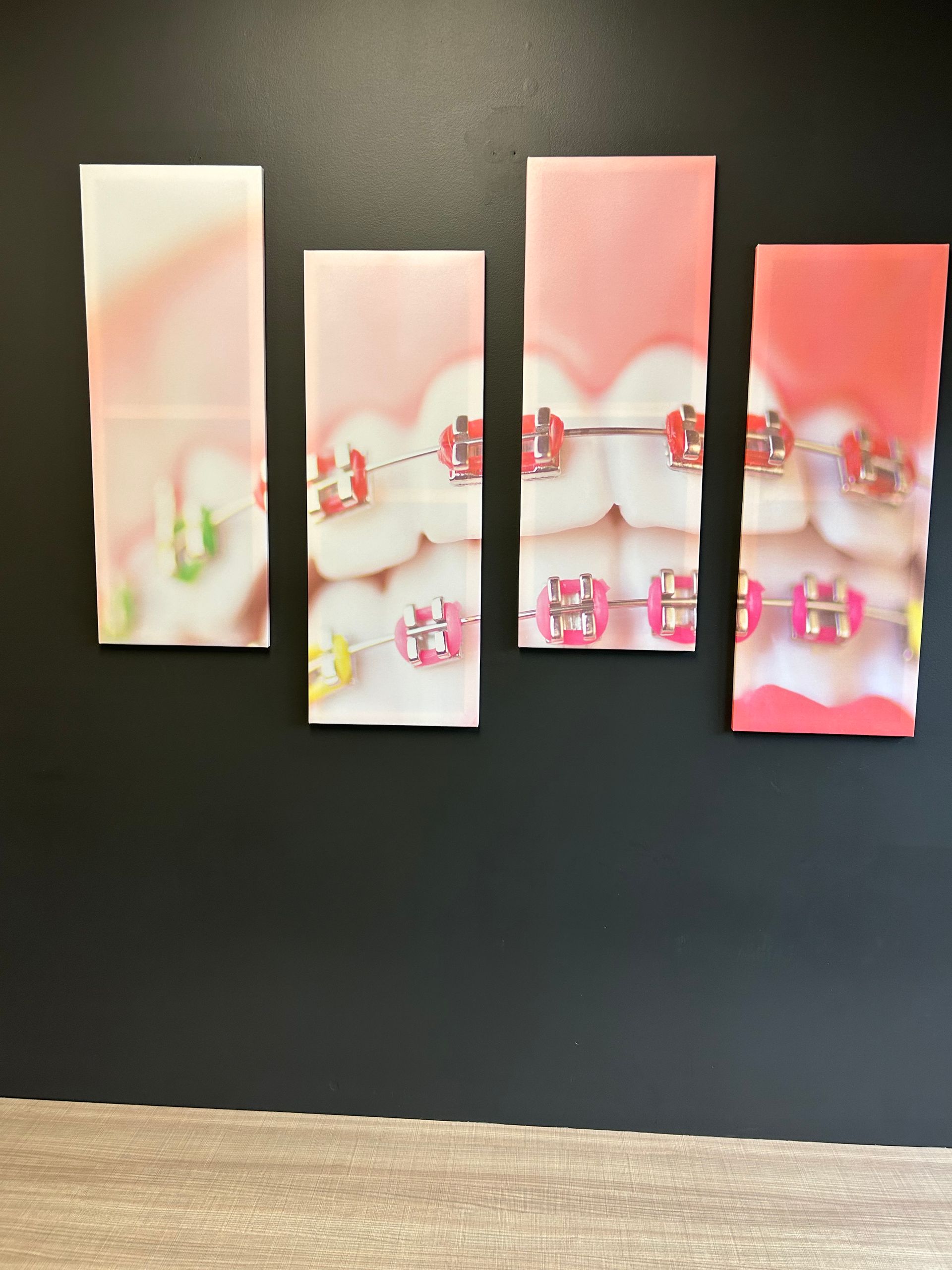 Colorful Braces Posted On The Wall - Albany, NY - Ideal Orthodontics