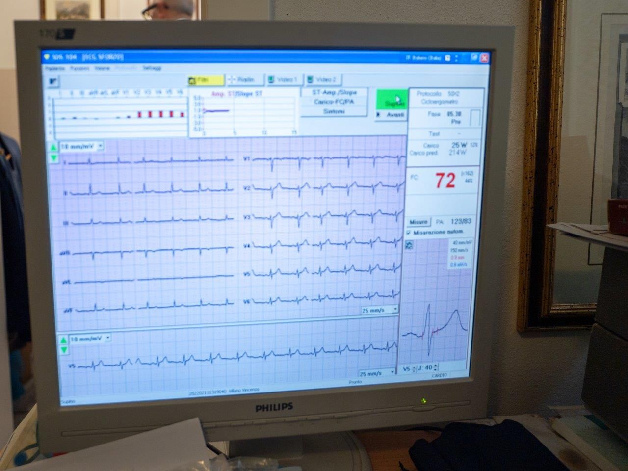 Un medico tiene in mano un cuore blu.