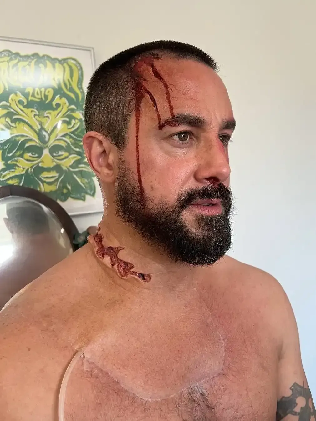 Man with makeup simulating a head wound and neck laceration, looking to the side.