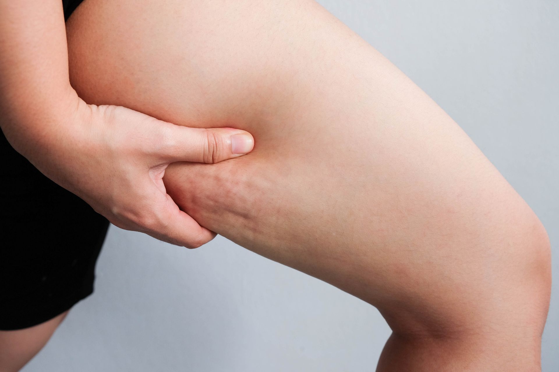 Body Treatment Removing Body Fat - Columbus, OH - Simply Sculpt