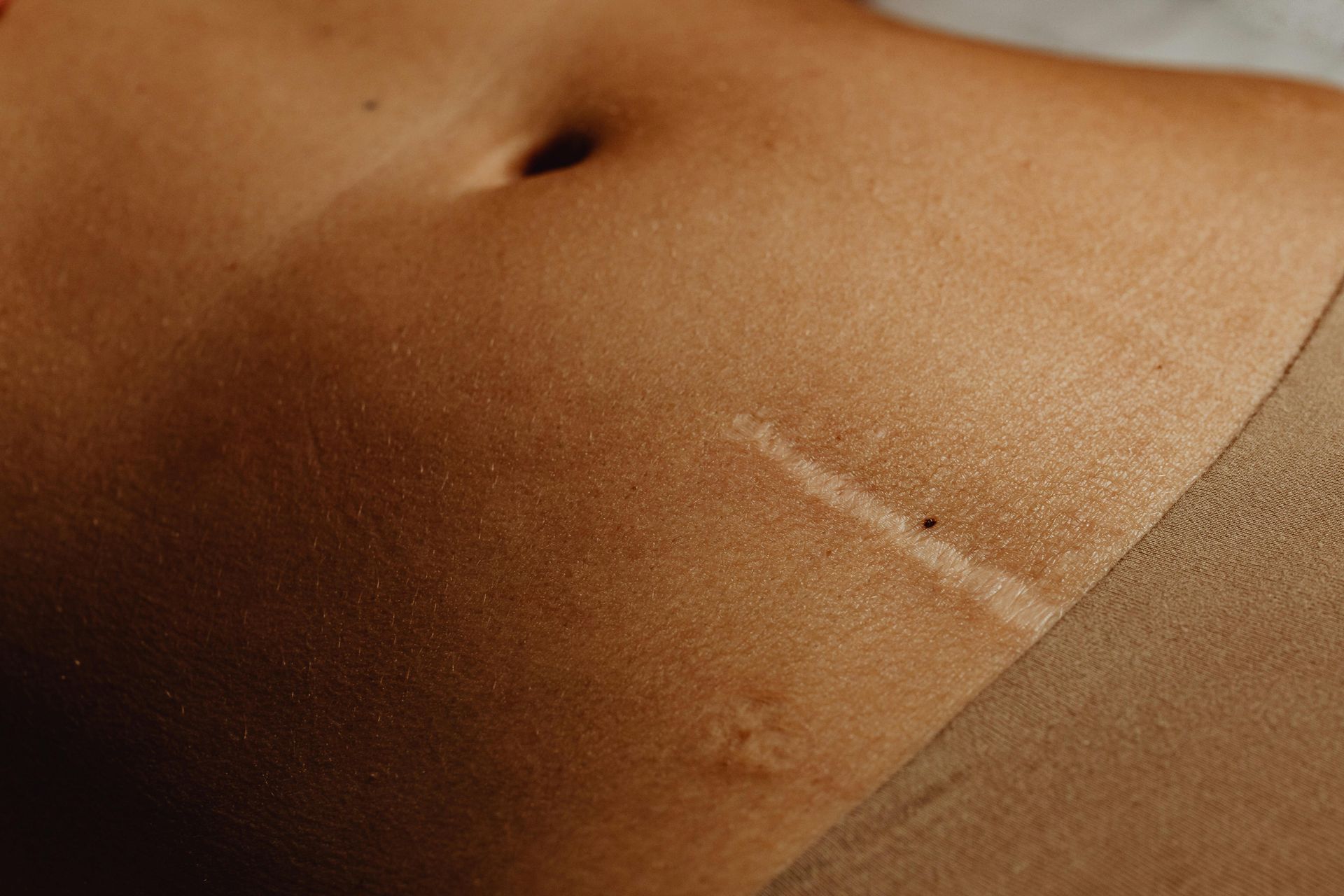 Close-up of a bare midsection with a small scar and skin texture visible
