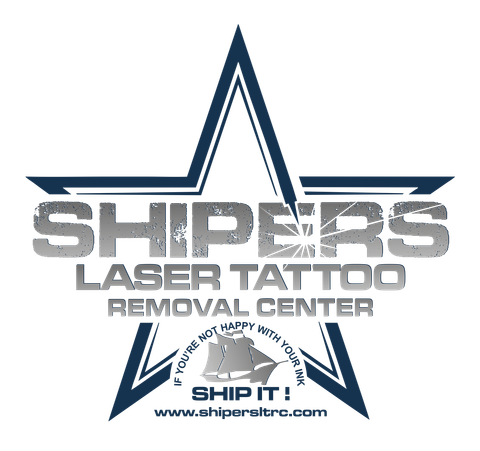 Shipers Laser Tattoo Removal Clinic in Dallas Texas